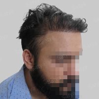 wrong hair repair result