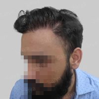 wrong hair repair result